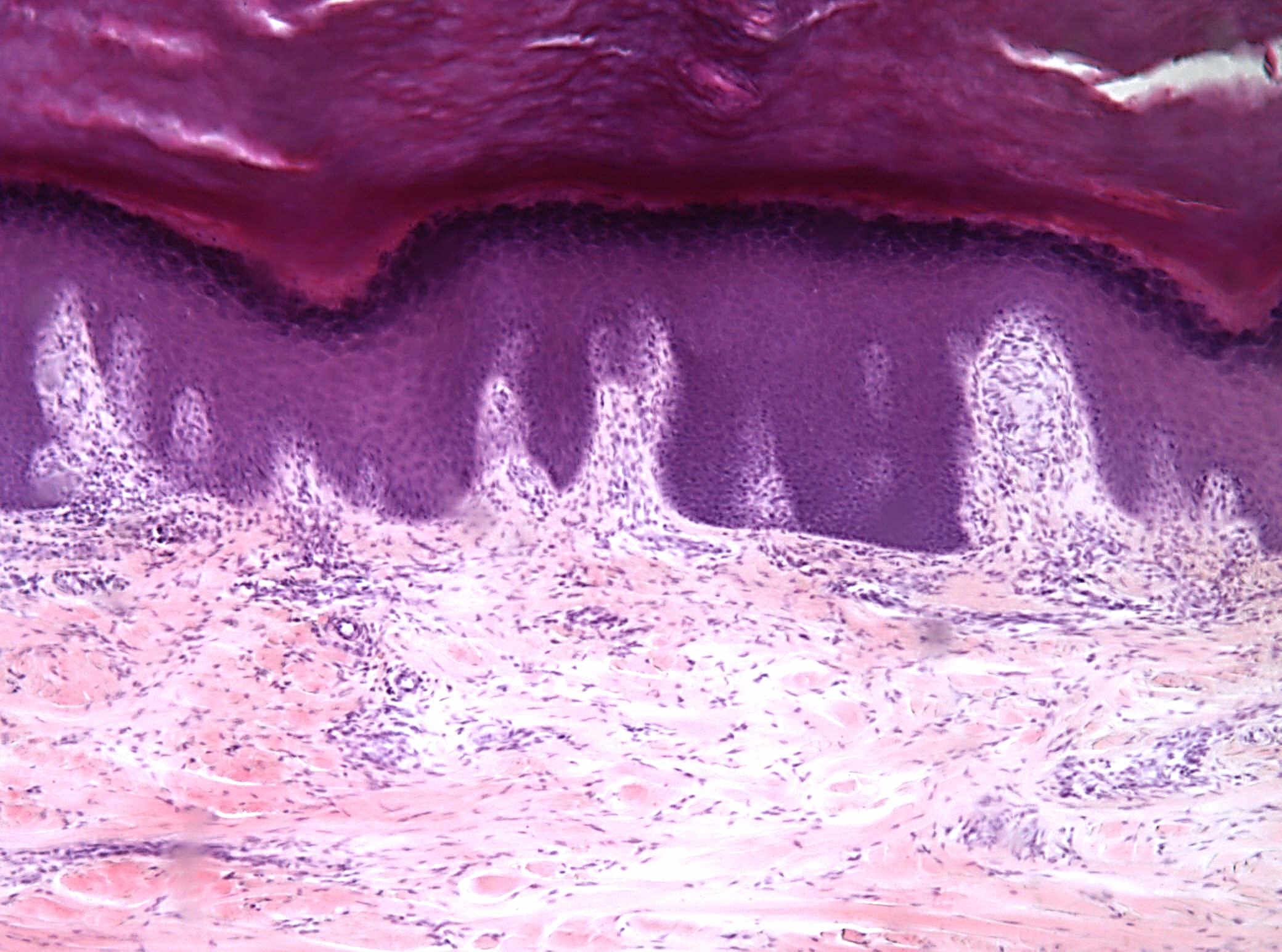 препарат кожи человека. препарат кожи человека. эпидермис толстой кожи гистология. кожа пальца человека толстая кожа препарат гистология. препарат кожи человека.